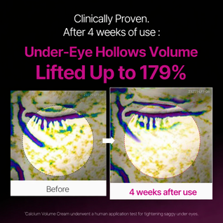 Cemenrete Calcium Intense Cream