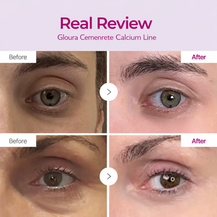 Cemenrete Calcium Intense Cream