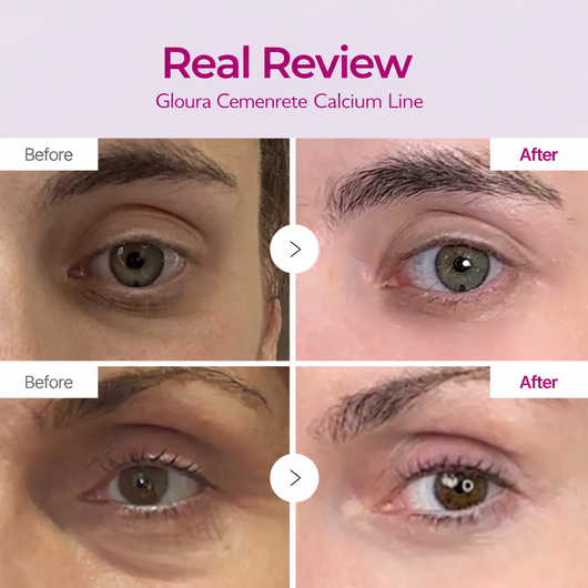 Cemenrete Calcium Intense Cream