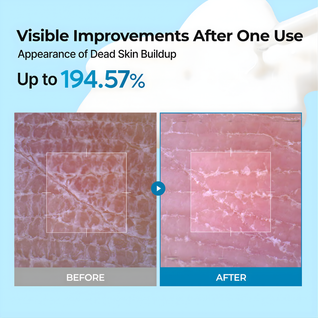 Peel Shot Exfoliating TX Serum