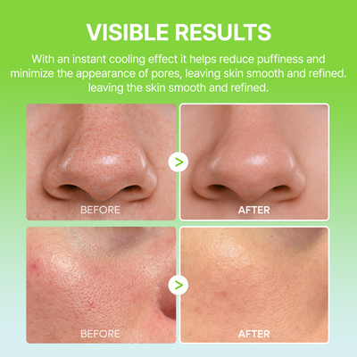 CACTIVA Pore Relief Multi Balm