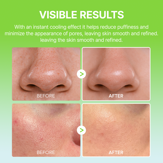 CACTIVA Pore Relief Multi Balm