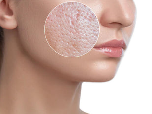 TARGETS ENLARGED PORES