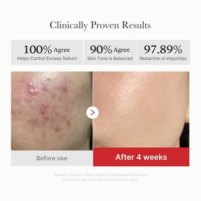 Red Succinic Acid Peeling Toner Pad
