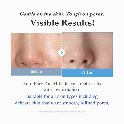 Zero Pore Toner Pad Mild